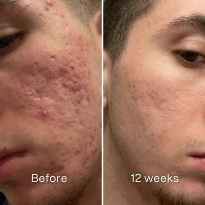 345 Relief Cream
