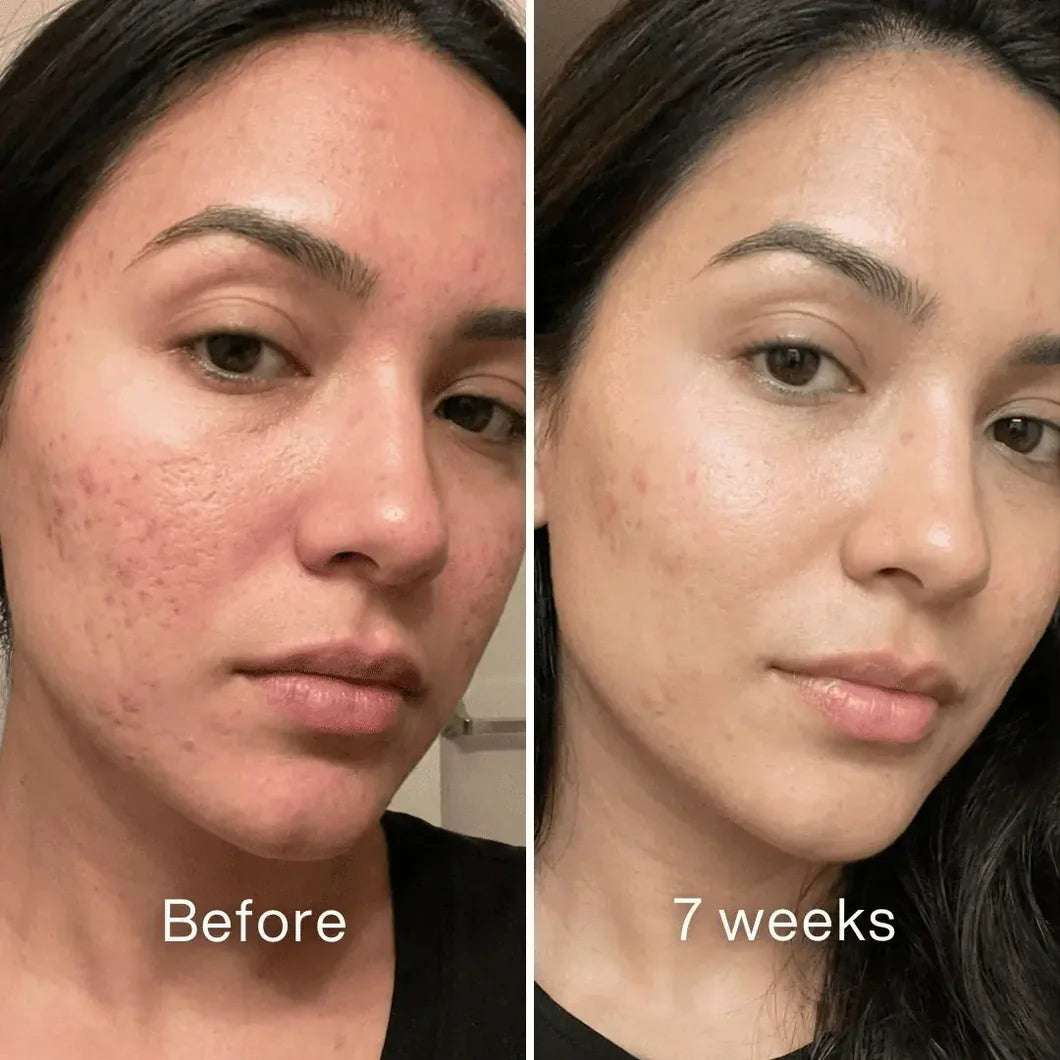 345 Relief Cream