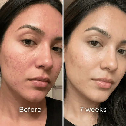 345 Relief Cream
